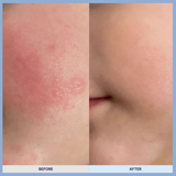 Cica Repair Cream -50g